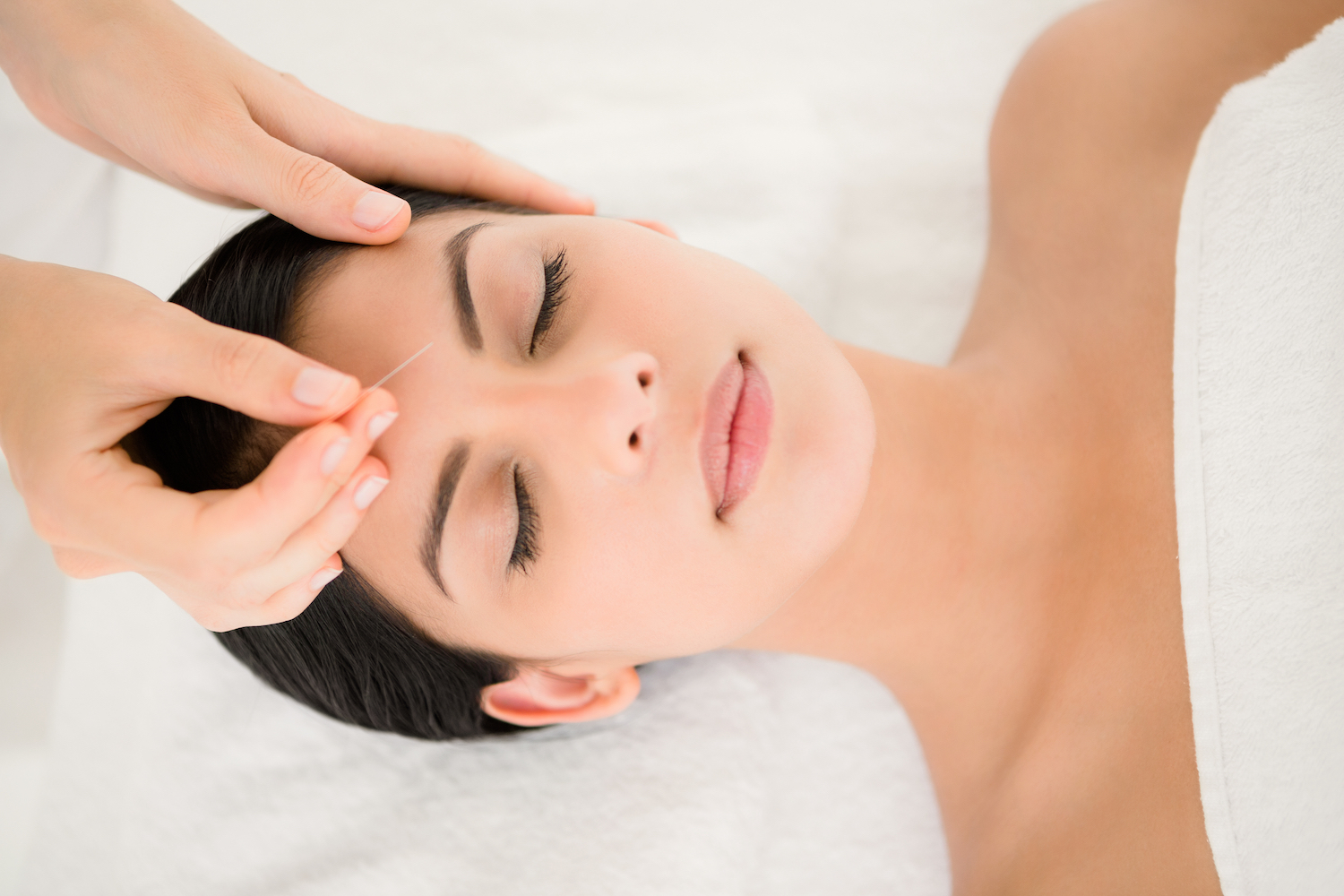 woman receiving acupuncture by Nicole Hohmann acupuncturist at acupuncture Evanston